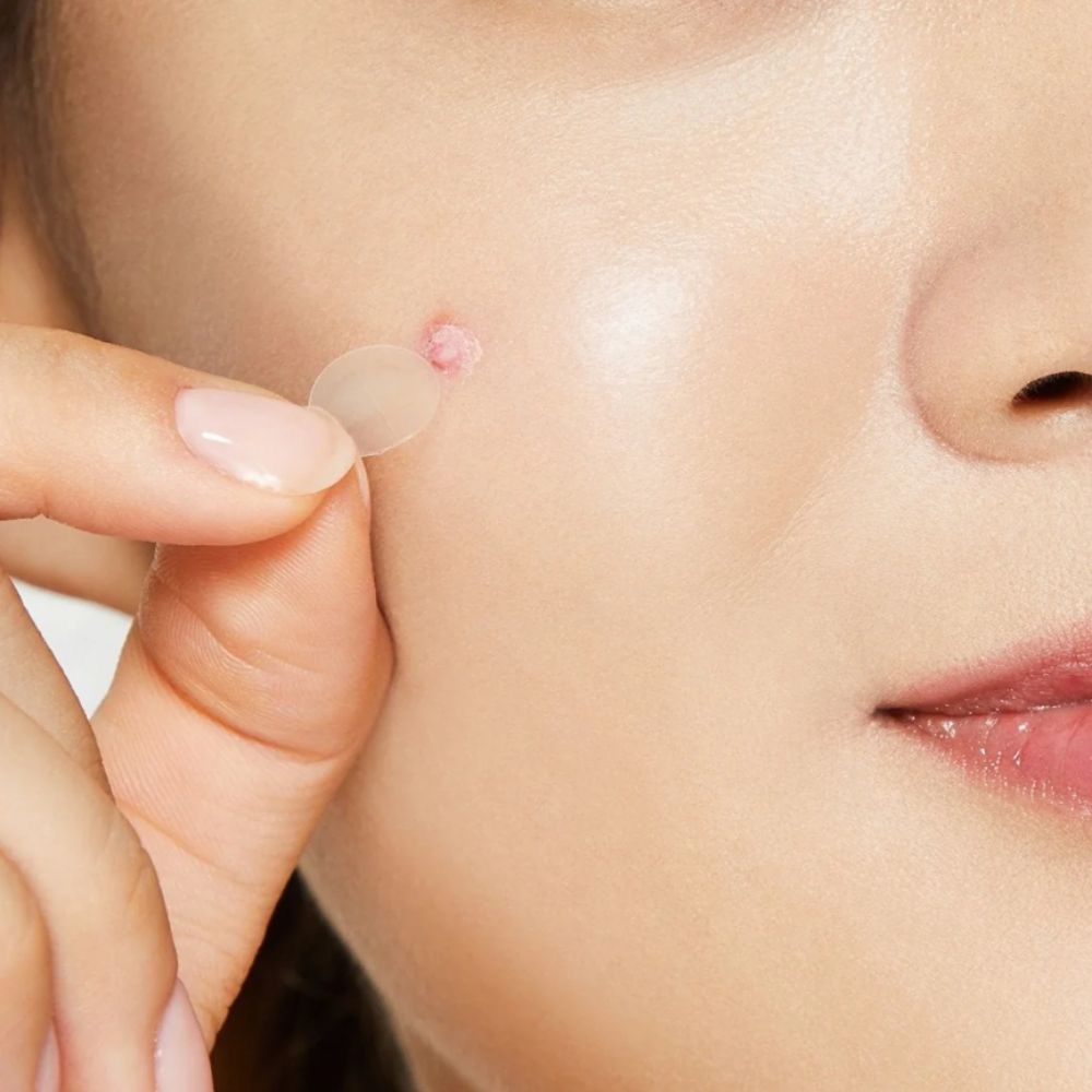 Acne Pimple Master - COSRX