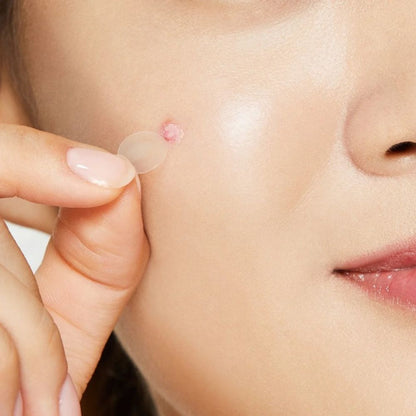 Acne Pimple Master - COSRX